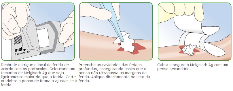 Modo de aplicação curativo Melgisorb AG